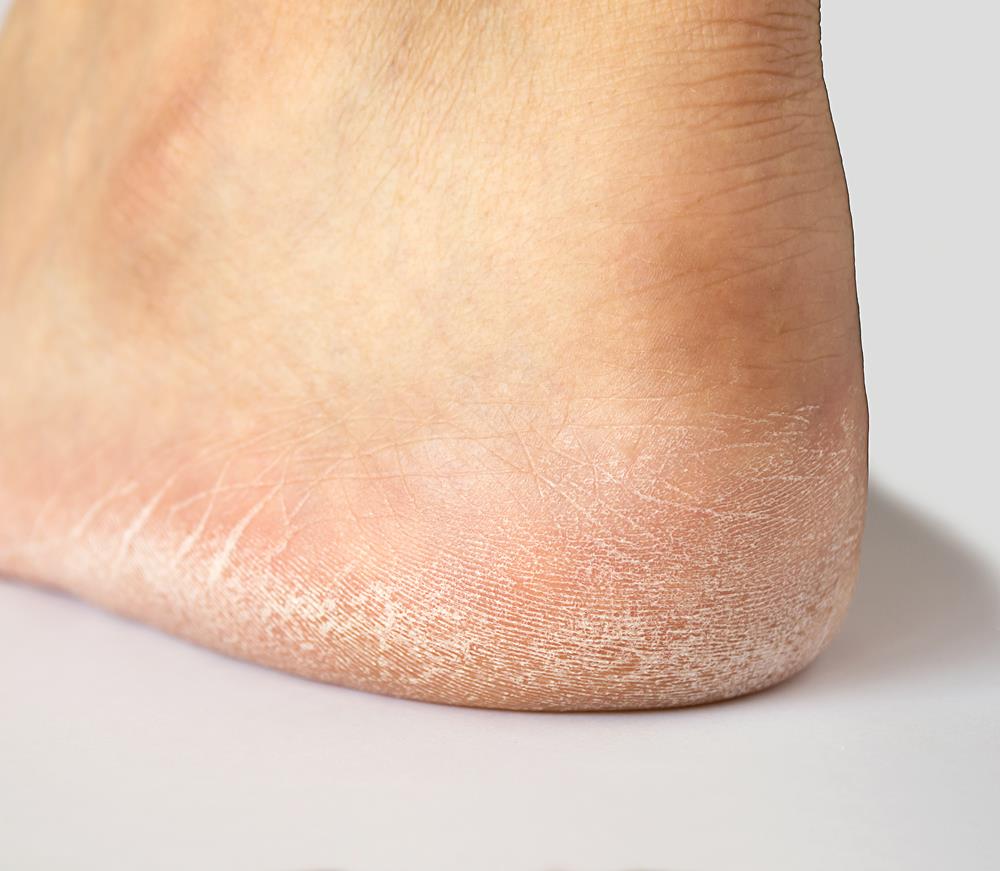 Flat Fee - Arizona Foot and Ankle Physicians Flat Feet Treatments in Scottsdale