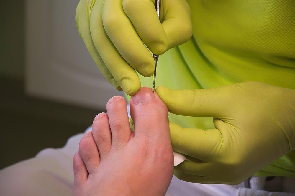 Foot Doctor - Arizona Foot and Ankle Physicians Foot doctor nearby