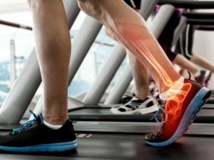 Ankle Sprains Treatments Scottsdale