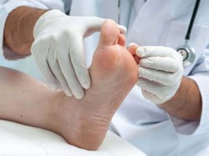 Foot fungus treatment at Arizona podiatry clinic
