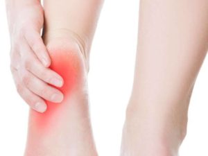 Effective Heel Pain Relief in Arizona - Arizona Foot and Ankle Physicians Heel pain treatment at Scottsdale podiatry clinic