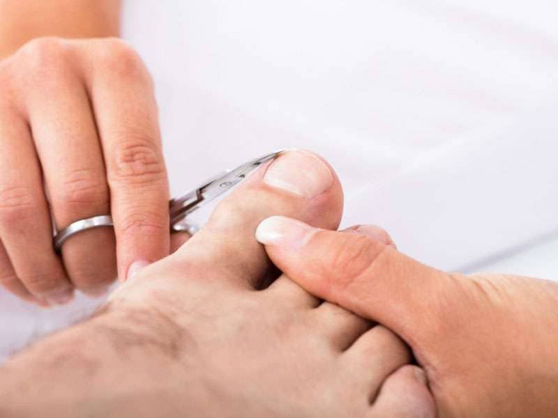 Expert Ingrown Toenail Removal in Scottsdale - Arizona Foot and Ankle Physicians Ingrown toenail treatment at Scottsdale podiatry clinic
