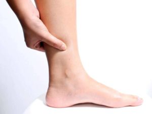 Poor Circulation treatments in Scottsdale