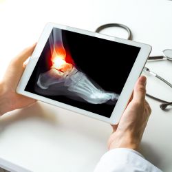 Ankle Sprains Treatments Near Me in Scottsdale, AZ