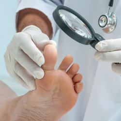 Athlete’s Foot Treatments Near Me in Scottsdale, AZ