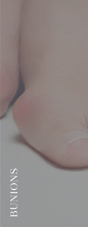 Bunions Near Me in Scottsdale, AZ
