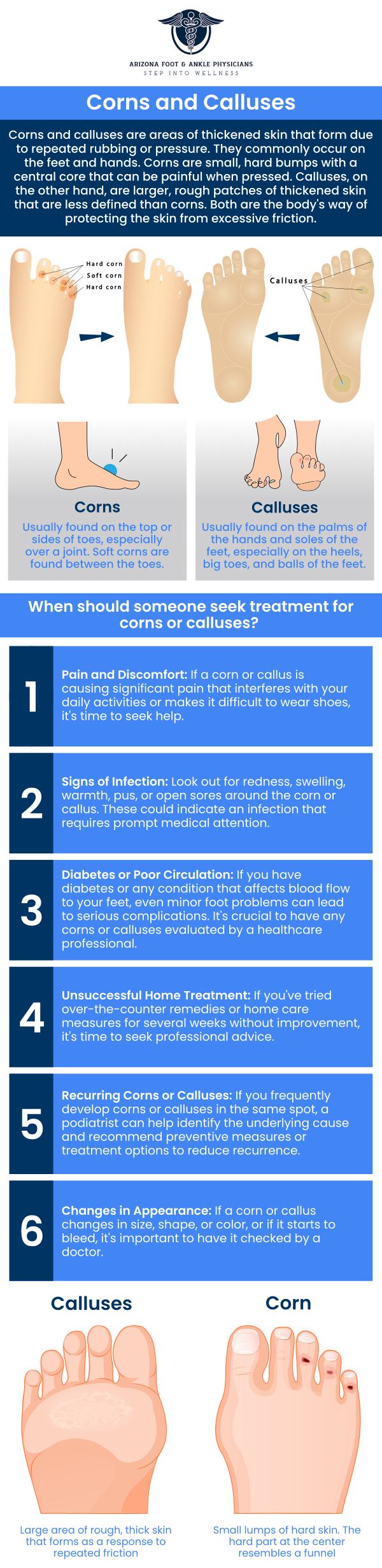 Common questions asked by patients: What are corns and calluses? What causes corns and calluses? Are corns and calluses painful? When should I see a doctor for corns and calluses? For more information, contact us or request an appointment online. We are conveniently located at 11390 E. Via Linda, Ste 102, Scottsdale, AZ 85259. We serve patients from Scottsdale AZ, Fountain Hills AZ, Paradise Valley AZ, Carefree AZ, Rio Verde AZ, and surrounding areas. Common questions asked by patients: What are corns and calluses? What causes corns and calluses? Are corns and calluses painful? When should I see a doctor for corns and calluses? For more information, contact us or request an appointment online. We are conveniently located at 11390 E. Via Linda, Ste 102, Scottsdale, AZ 85259. We serve patients from Scottsdale AZ, Fountain Hills AZ, Paradise Valley AZ, Carefree AZ, Rio Verde AZ, and surrounding areas.