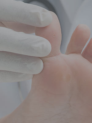 Diabetic Foot Care Near Me in Scottsdale, AZ