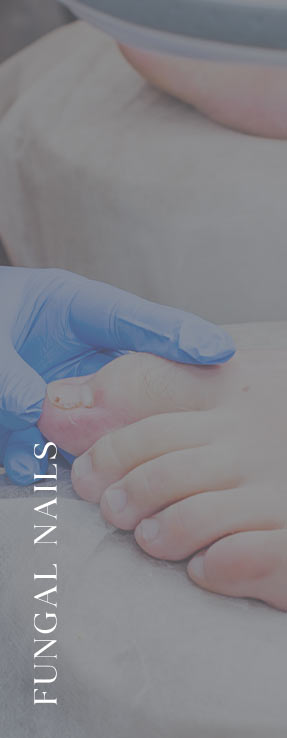 Fungal Nails Near Me in Scottsdale, AZ