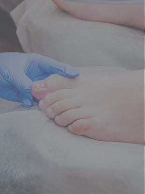 Fungal Nails Near Me in Scottsdale, AZ
