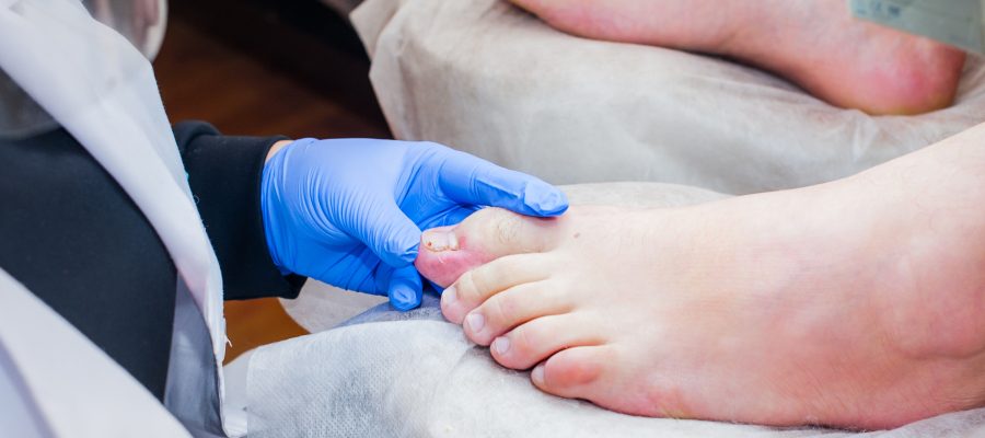 Fungal Toenail Treatment Specialist Near Me in Scottsdale, AZ Fungal Toenail Treatment Specialist Near Me in Scottsdale, AZ