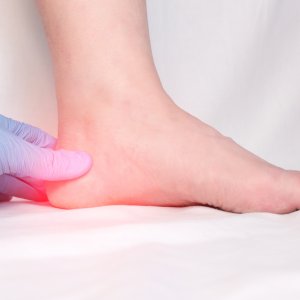 Heel Pain Treatments Near Me in Scottsdale, AZ