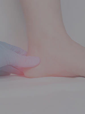 Heel Pain Near Me in Scottsdale, AZ