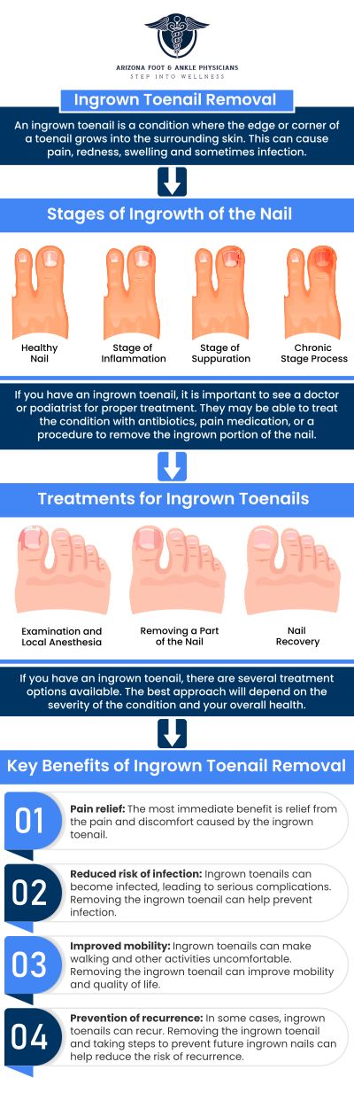 Dr. Nathan Plaskey at Arizona Foot and Ankle Physicians provides specialized ingrown toenail treatment. Whether you need conservative treatments like proper nail care and antibiotic therapy or require surgical intervention, we are equipped to help you find relief. Our approach ensures a thorough understanding of your condition and offers advanced solutions to treat and prevent future ingrown toenails. For more information, contact us or request an appointment online. We are conveniently located at 11390 E. Via Linda, Ste 102, Scottsdale, AZ 85259. Dr. Nathan Plaskey at Arizona Foot and Ankle Physicians provides specialized ingrown toenail treatment. Whether you need conservative treatments like proper nail care and antibiotic therapy or require surgical intervention, we are equipped to help you find relief. Our approach ensures a thorough understanding of your condition and offers advanced solutions to treat and prevent future ingrown toenails. For more information, contact us or request an appointment online. We are conveniently located at 11390 E. Via Linda, Ste 102, Scottsdale, AZ 85259.