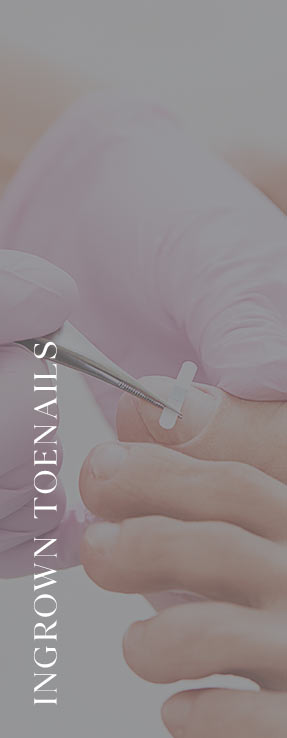 Ingrown Toenails Near Me in Scottsdale, AZ