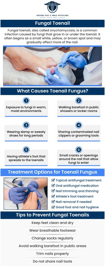 If you are struggling with a fungal toenail infection, Dr. Nathan Plaskey at Arizona Foot and Ankle Physicians is here to help. As a leading specialist, he offers advanced therapies tailored to your specific needs. We focus on not only eliminating the infection but also preventing future occurrences, ensuring long-lasting results. Trust our team to restore your toenail health and get you back to feeling confident and comfortable. For more information, contact us or request an appointment online. We are conveniently located at 11390 E. Via Linda, Ste 102, Scottsdale, AZ 85259. If you are struggling with a fungal toenail infection, Dr. Nathan Plaskey at Arizona Foot and Ankle Physicians is here to help. As a leading specialist, he offers advanced therapies tailored to your specific needs. We focus on not only eliminating the infection but also preventing future occurrences, ensuring long-lasting results. Trust our team to restore your toenail health and get you back to feeling confident and comfortable. For more information, contact us or request an appointment online. We are conveniently located at 11390 E. Via Linda, Ste 102, Scottsdale, AZ 85259.